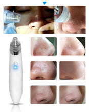 Carregar imagem no visualizador da galeria, Remover Cravos Elétrico Limpeza  e Esfoliante Facial de Cuidados com a Pele Instrumento de Beleza e Limpador de Manchas